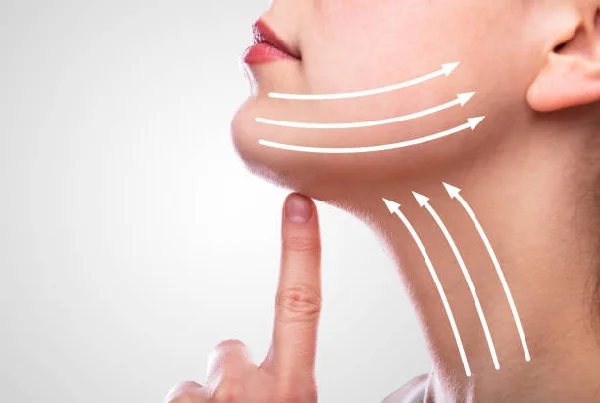 Neck Lift