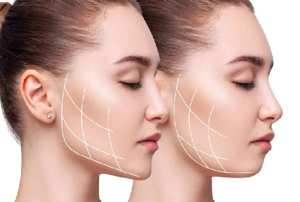 Jaw Corrective Surgeries